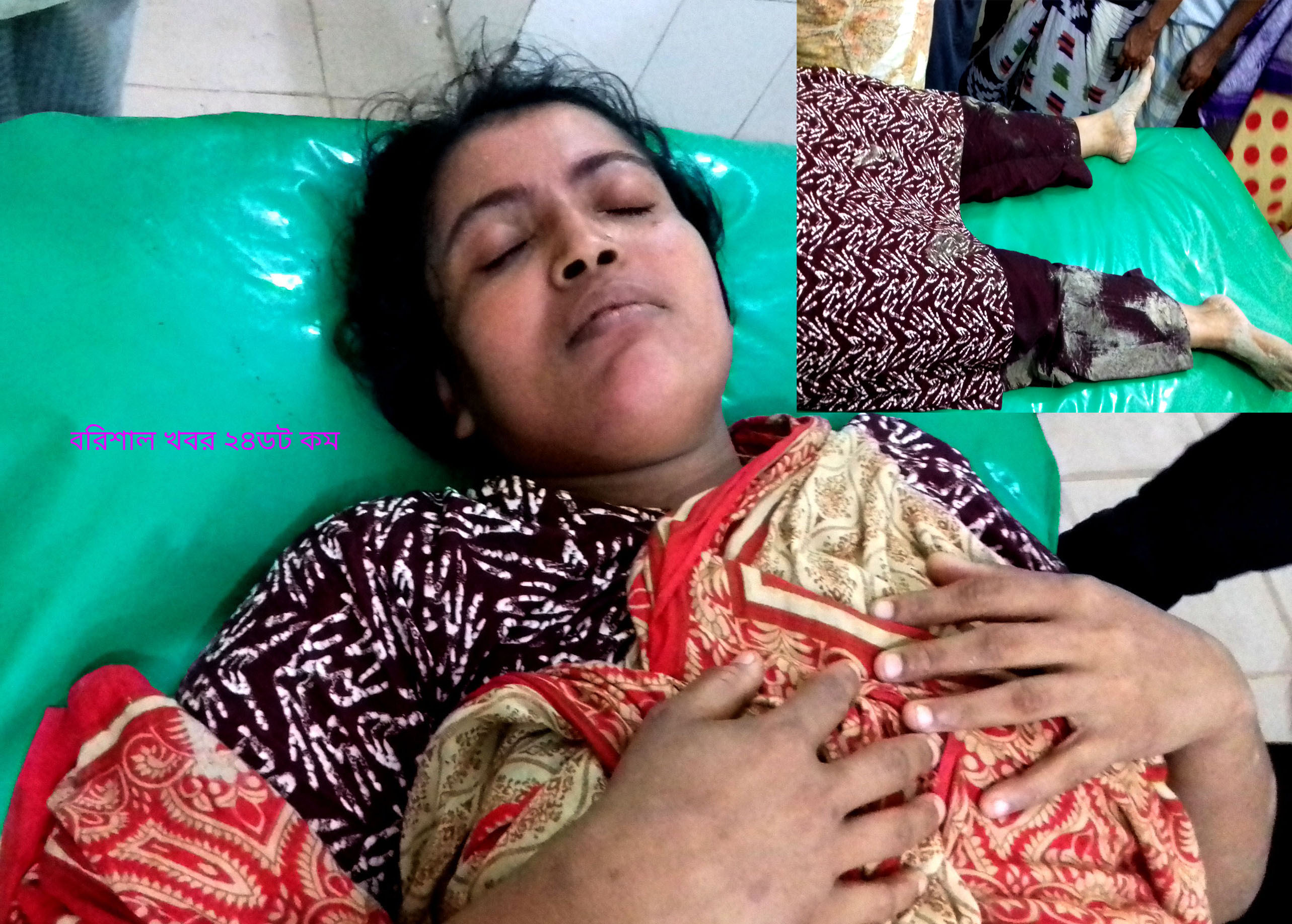 বাউফলে তুচ্ছ ঘটনায় এক নারীকে পিটিয়ে জখম
