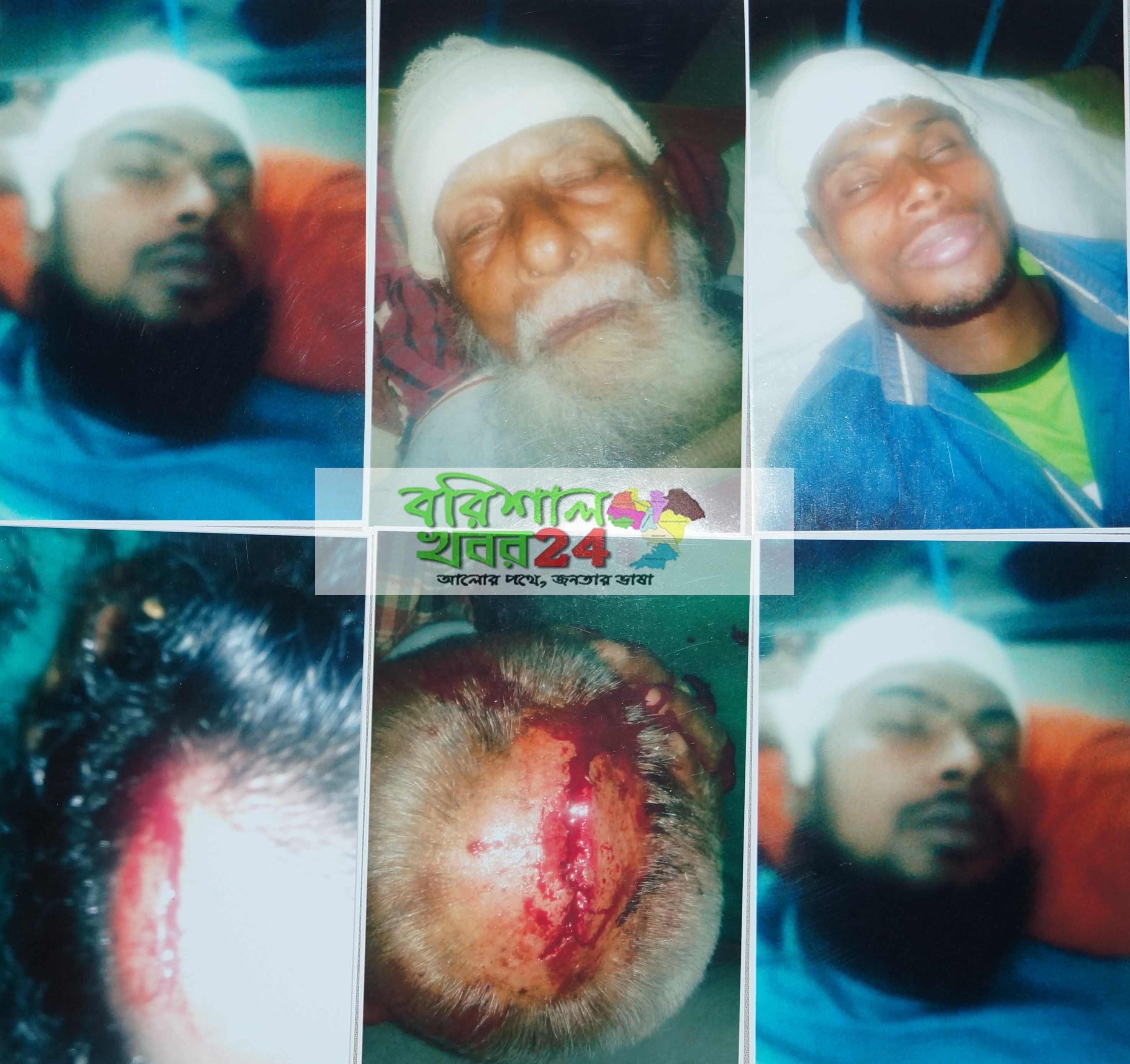 পটুয়াখালীতে জমিজমা সংক্রান্ত বিরোধে আহত ৫