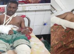 রাজাপুরের গাছ ব্যবসায়ী আওলাদ ‘একন আমারে পঙ্গু অইয়া চলতে অইবে’