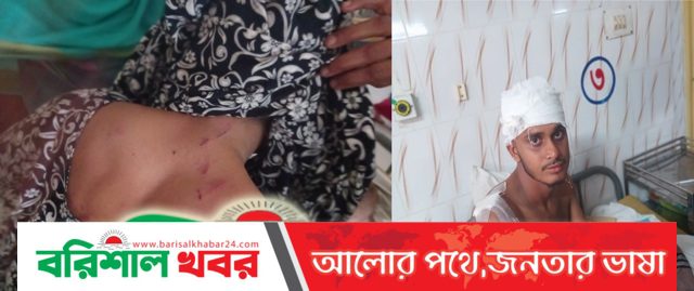 ঝালকাঠিতে জমিজমার বিরোধে প্রতিপক্ষের হামলায় মা ও ছেলে আহত