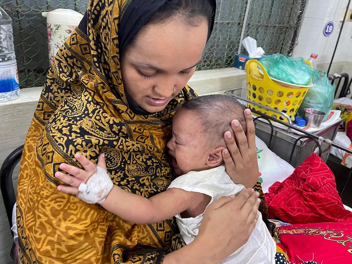 হামের সঙ্গে নিউমোনিয়ার জটিলতা, দূরদূরান্তের শিশুদের শেষ ভরসা ঢাকা